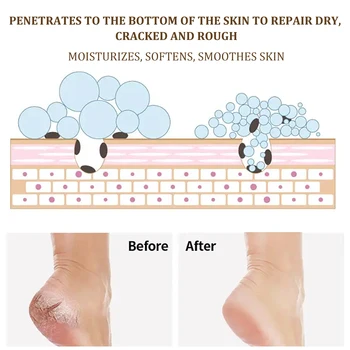 Roke in noge razpokane krema globoko vlažilno, kožo vlažilno repair cream anti-sušenje nega nog in popravila smetane
